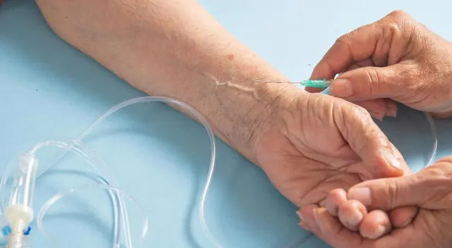 Hidratación intravenosa Hidratación intravenosa