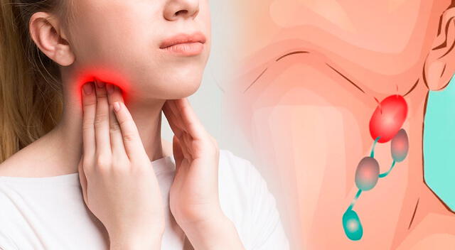La terapia CAR-T modifica genéticamente los linfocitos del paciente para atacar las células cancerígenas, un avance clave en el tratamiento del linfoma.