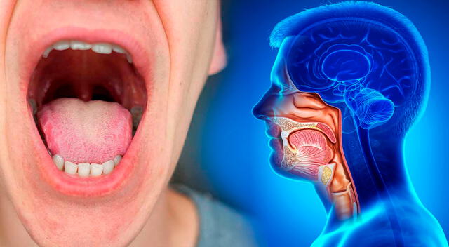 El dolor de garganta persistente, acompañado de bultos o cambios en la voz, podría estar relacionado con un tipo de cáncer que afecta la parte posterior de la lengua. El dolor de garganta persistente, acompañado de bultos o cambios en la voz, podría estar relacionado con un tipo de cáncer que afecta la parte posterior de la lengua.