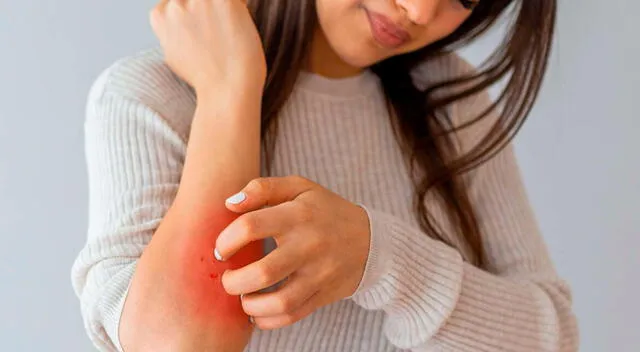 Detectar a tiempo los signos de cáncer de piel puede marcar una gran diferencia en el tratamiento y pronóstico. Detectar a tiempo los signos de cáncer de piel puede marcar una gran diferencia en el tratamiento y pronóstico.