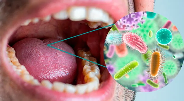Investigaciones recientes sugieren que ciertas bacterias presentes en la boca pueden aumentar el riesgo de desarrollar cáncer de páncreas. 