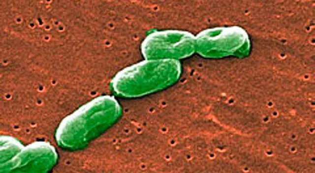 Para evitar la propagación de esta bacteria hospitalaria, es fundamental reforzar los protocolos de bioseguridad. Para evitar la propagación de esta bacteria hospitalaria, es fundamental reforzar los protocolos de bioseguridad.