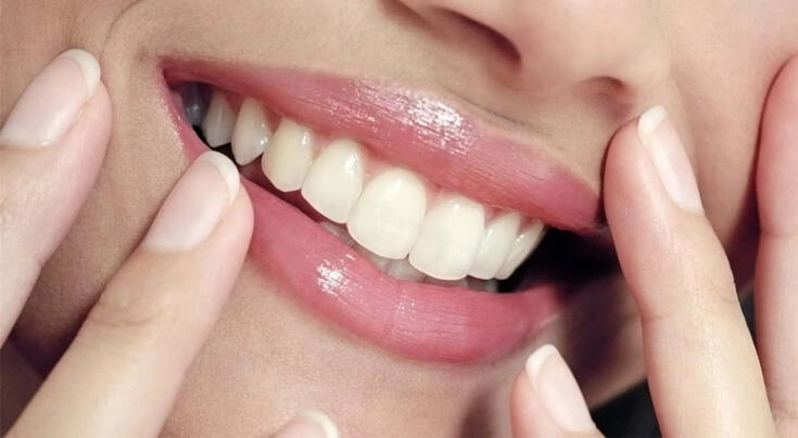 Este es el remedio natural que elimina el sarro en los dientes