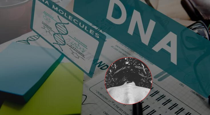 Síndrome de Stickler: un trastorno genético multisistémico que suele pasar desapercibido.