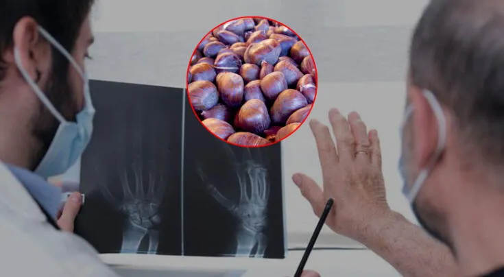 De los intestinos a las articulaciones: una conexión sorprendente que puede mejorar a través de ciertos alimentos como los frutos secos.