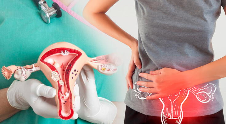 Prevención del cáncer de cuello uterino.