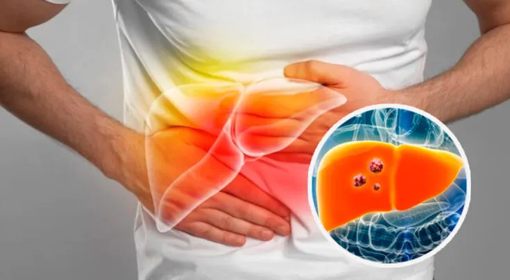 Tratamientos efectivos y hábitos saludables para el cáncer de hígado.