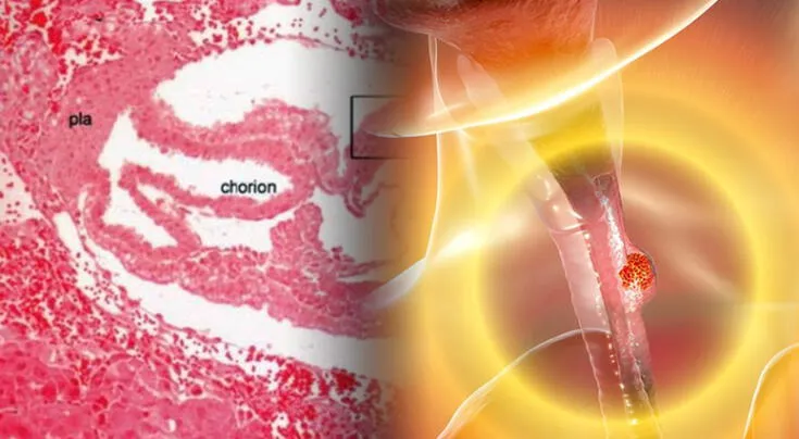 Un giro inesperado en la comprensión del cáncer.
