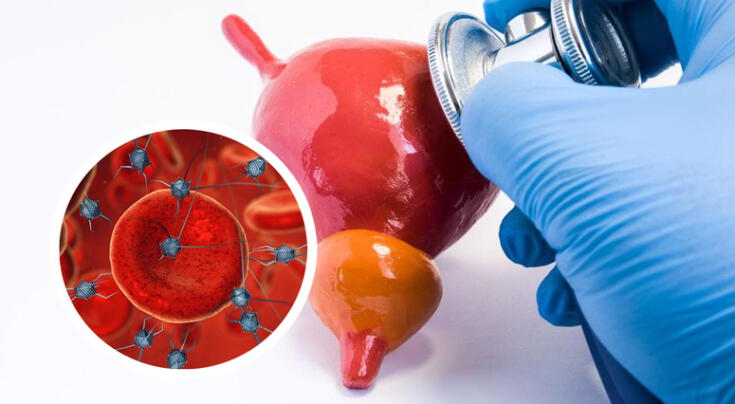 Científicos descubren nuevo tratamiento para el cáncer de vejiga.
