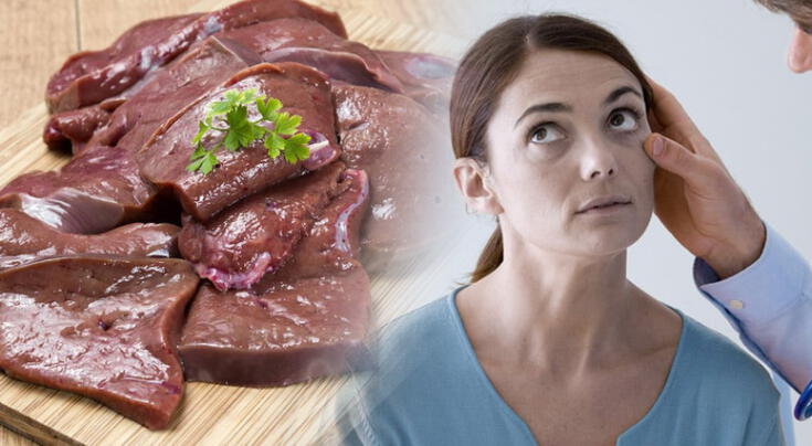 ¿Comer hígado realmente ayuda a combatir la anemia?