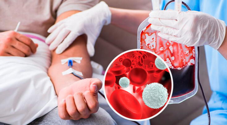 Nuevo tratamiento podría reemplazar la quimioterapia en niños con Leucemia.