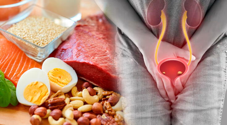 Los 5 alimentos que pueden complicar la infección urinaria.