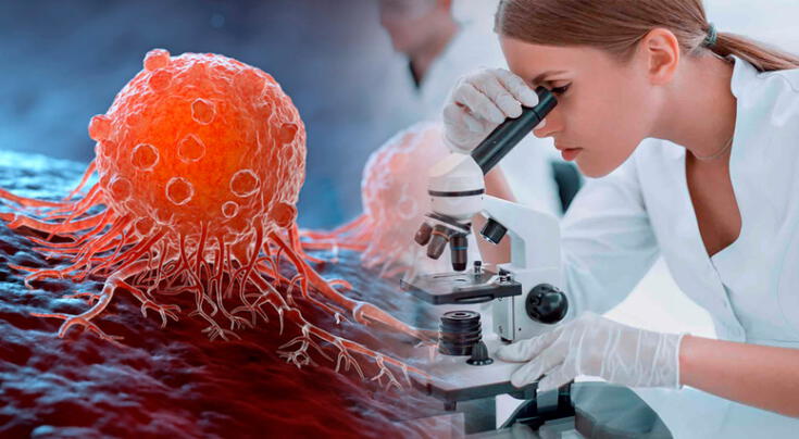 Un cambio en el color en las heces podría ser una señal temprana de un cáncer peligroso.