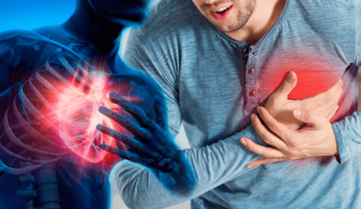 Un cardiólogo revela la causa detrás de los infartos en jóvenes saludables.