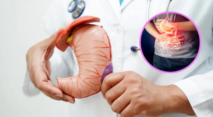 Dieta preventiva para cáncer gástrico y esofágico: qué incluir y qué evitar según especialistas
