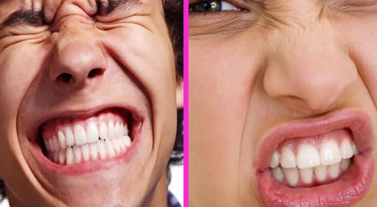 Bruxismo: causas, síntomas y cómo dejar de rechinar los dientes antes de que dañe tu salud