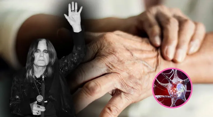 Parkinson: el trastorno neurológico que enfrentó Ozzy Osbourne, causas, síntomas y tratamientos
