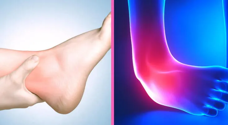 Cómo fortalecer tendones y ligamentos para evitar lesiones.