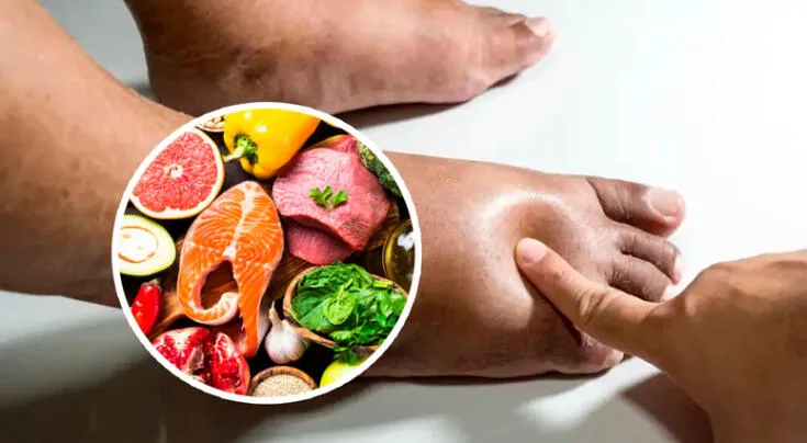 Expertos recomiendan estos alimentos para combatir la retención de líquidos.