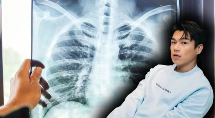 ¿Es posible superar un cáncer de pulmón en estadio 4? La enfermedad que enfrenta el actor Will Or Wai-lam