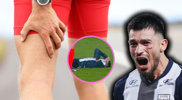 ¿Qué es un desgarro en el bíceps femoral, cómo se trata y cuánto tarda la recuperación? Lesión que deja fuera a Alan Cantero del Alianza Lima vs. Sporting Cristal