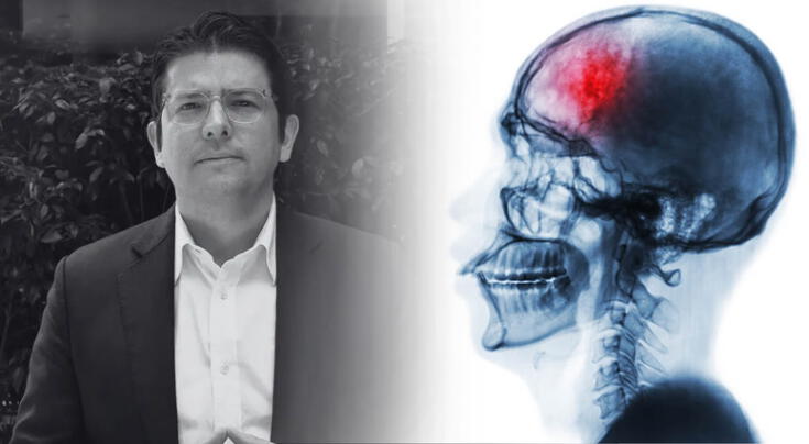 ¿Qué tan letales pueden ser las lesiones cerebrales?
