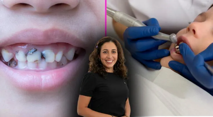 Día del Niño: 3 enfermedades bucales más comunes en niños y cómo prevenirlas, según experta