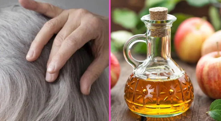 Vinagre de manzana: el aliado natural para reducir la apariencia de las canas, según expertos