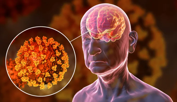 Terapias psiquiátricas podrían ayudar a sanar el cerebro tras un ACV.