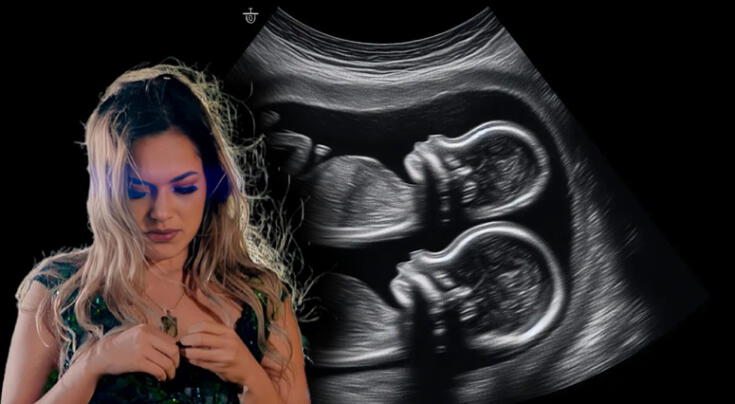 Lesly Águila, de Corazón Serrano, responde a conmovedora pregunta sobre su gemela que murió: el impacto de la muerte de un gemelo en el otro, según expertos Lesly Águila, de Corazón Serrano, responde a conmovedora pregunta sobre su gemela que murió: el impacto de la muerte de un gemelo en el otro, según expertos