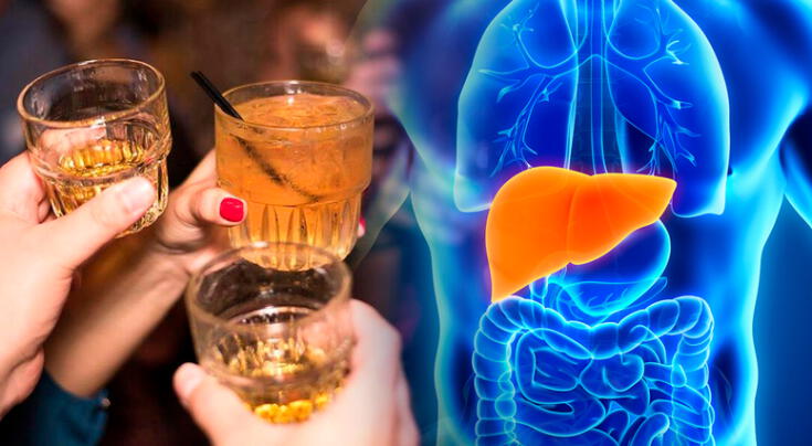 Qué sucede en tu hígado tras el consumo excesivo de alcohol.