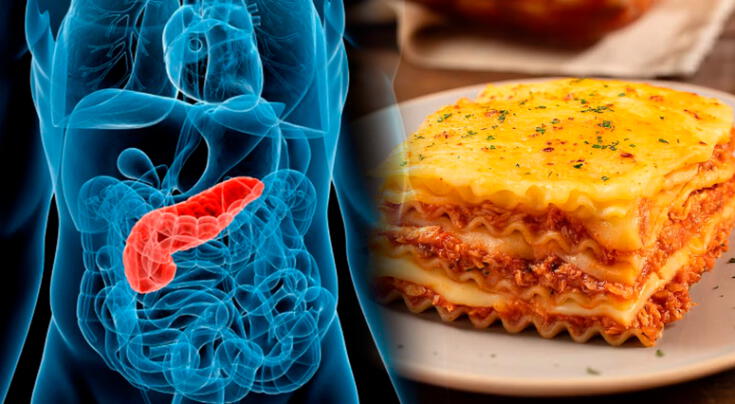 Alimentos inesperados pueden formar parte de una dieta para cáncer de páncreas. Alimentos inesperados pueden formar parte de una dieta para cáncer de páncreas.