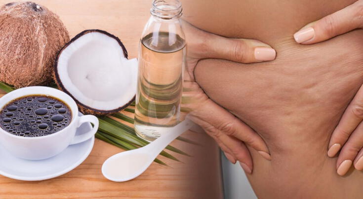 El truco casero con café y aceite de coco para la celulitis. El truco casero con café y aceite de coco para la celulitis.