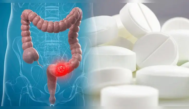 Una aspirina diaria podría prevenir recaídas en cáncer de colon. Una aspirina diaria podría prevenir recaídas en cáncer de colon.