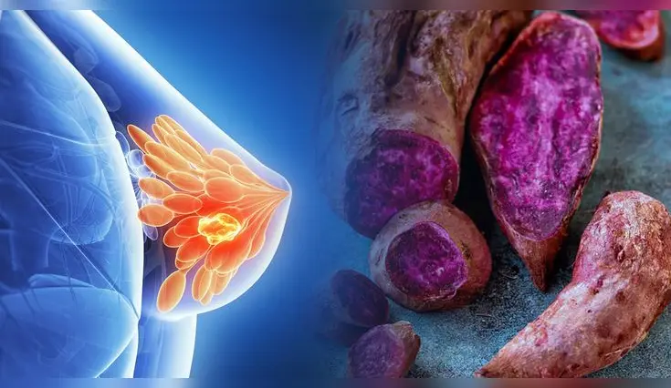 Cáscara del camote morado podría ayudar a prevenir el cáncer de mama. Cáscara del camote morado podría ayudar a prevenir el cáncer de mama.