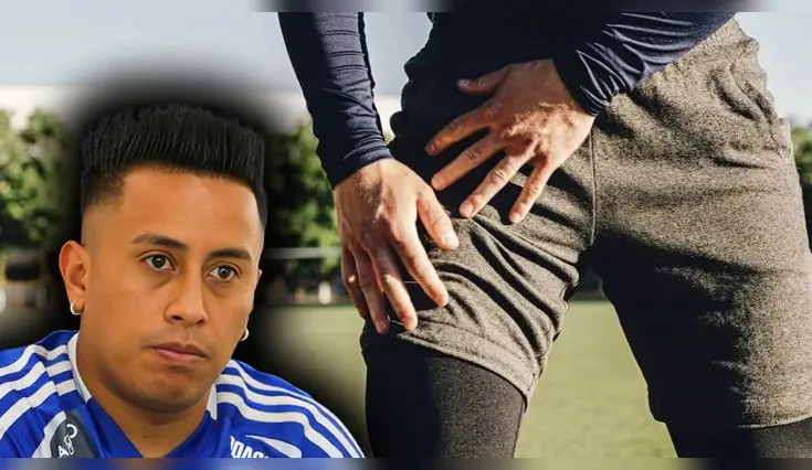 Lesión miosfacial en el recto anterior: causas, síntomas y tratamiento, dolencia que afectó a Christian Cueva y motivó su retorno a Perú